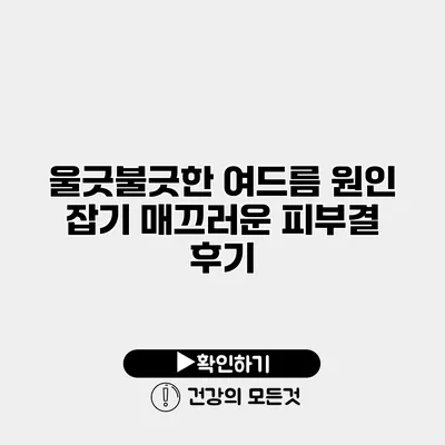 울긋불긋한 여드름 원인 잡기 매끄러운 피부결 후기